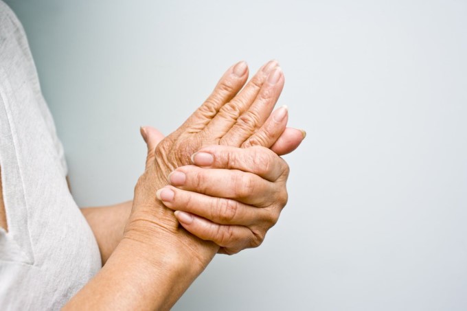 Người bệnh có thể cảm thấy tê hoặc yếu đột ngột ở tay hoặc chân