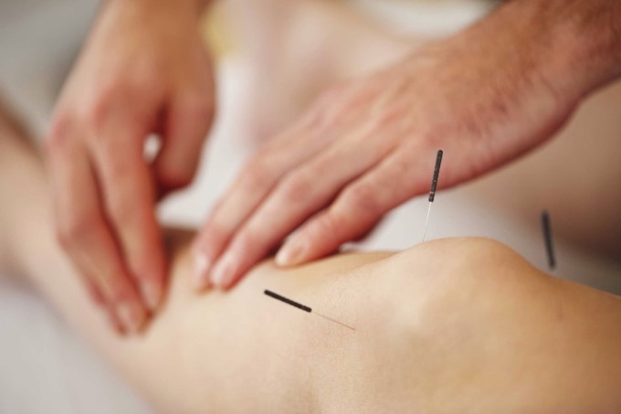 Châm Cứu Là Một Cách Điều Trị Gai Khớp Gối 