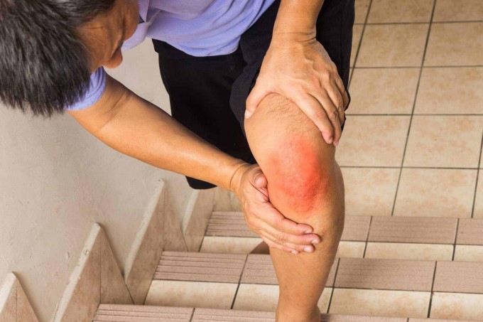 Nhiều Trường Hợp Phải Sau 2 - 3 Ngày Mới Phát Hiện Bị Rách Sụn Chêm Vì Cơn Đau Không Đến Ngay Sau Khi Bị Chấn Thương