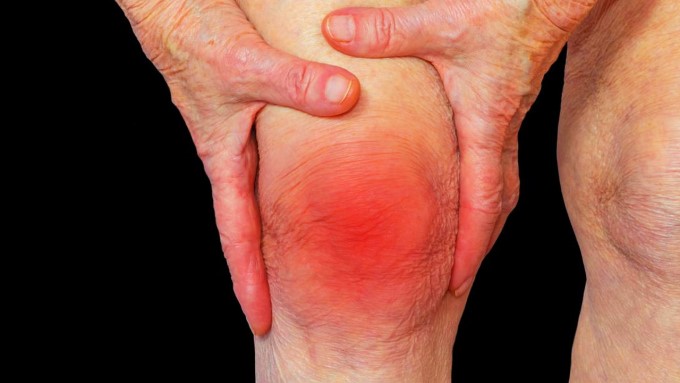 Vi Khuẩn Đọng Lại Ở Đầu Xương Tạo Thành Các &Quot;Củ Lao&Quot;