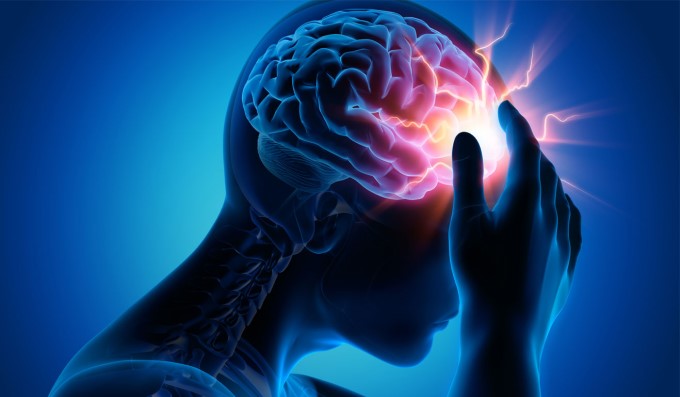 Các tinh thể urat lắng đọng, tích tụ ở mạch máu não gây nên biến chứng đột quỵ cực kỳ nguy hiểm