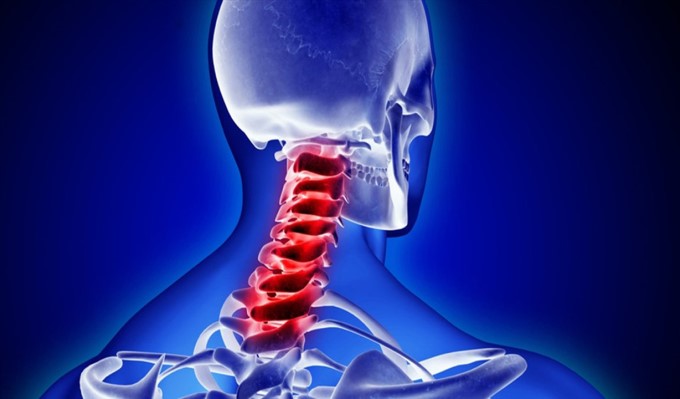 Thoái Hoá Đốt Sống Cổ Cũng Gây Đau Cổ Vai Gáy