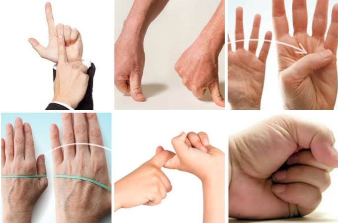 Ở Khớp Ngón Tay Bình Thường Sự Chuyển Động Xảy Ra Trơn Tru