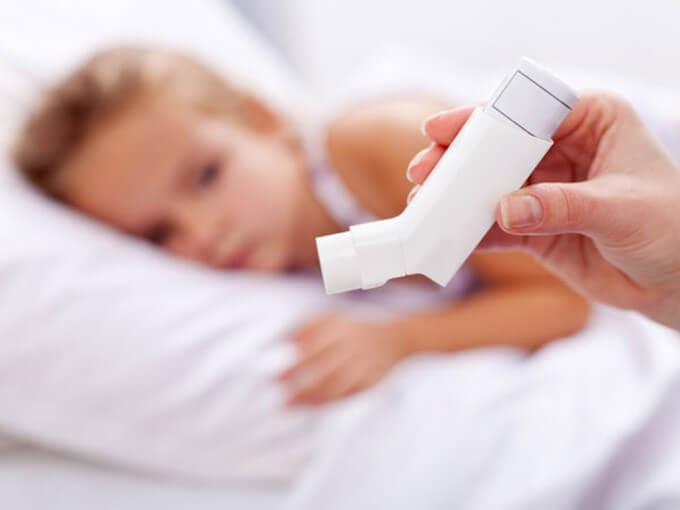 Suyễn Là Dấu Hiệu Phổ Biến Nhất Của Hội Chứng Churg Strauss