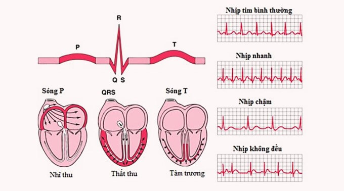 Chẩn Đoán Cận Lâm Sàng Bằng Phương Pháp Điện Tâm Đồ