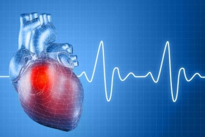 Nhịp Tim Bất Thường Cũng Có Thể Là Nguyên Nhân Gây Đau Thắt Ngực