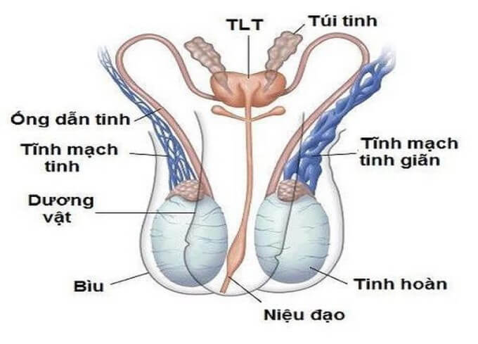 Giãn Tĩnh Mạch Thừng Tinh Có Thể Dẫn Đến Vô Sinh
