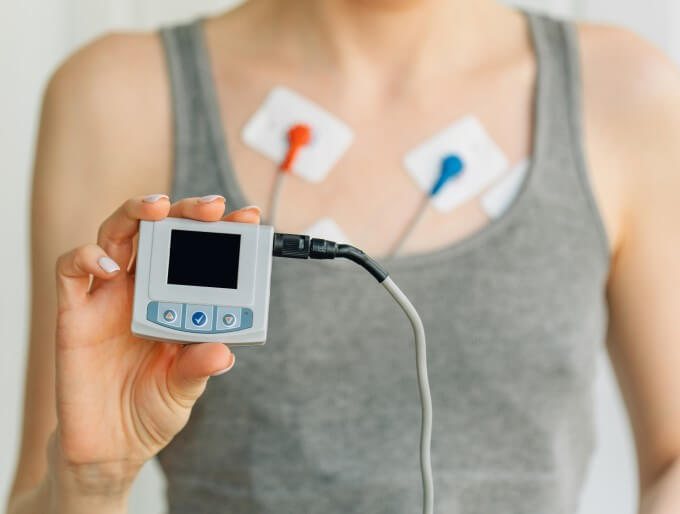Theo Dõi Ecg