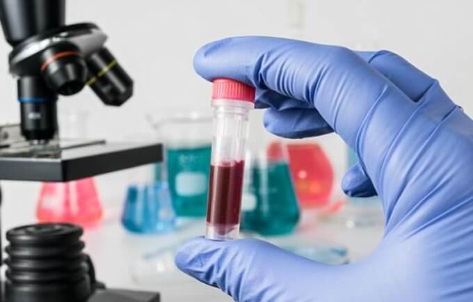 Xét nghiệm máu kiểm tra sự rò rỉ của enzyme từ trong tim vào máu
