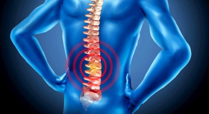 Thoát Hoá Cột Sống Là Một Trong Những Nguyên Nhân Dẫn Đến Thoát Vị Đĩa Đệm