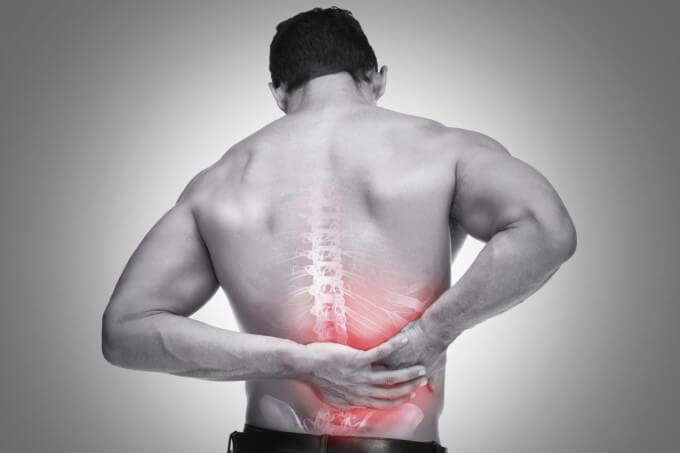 Những Cơn Đau Sẽ Xuất Hiện Nơi Đĩa Đệm Bị Thoát Vị Là Biểu Hiện Đầu Tiên