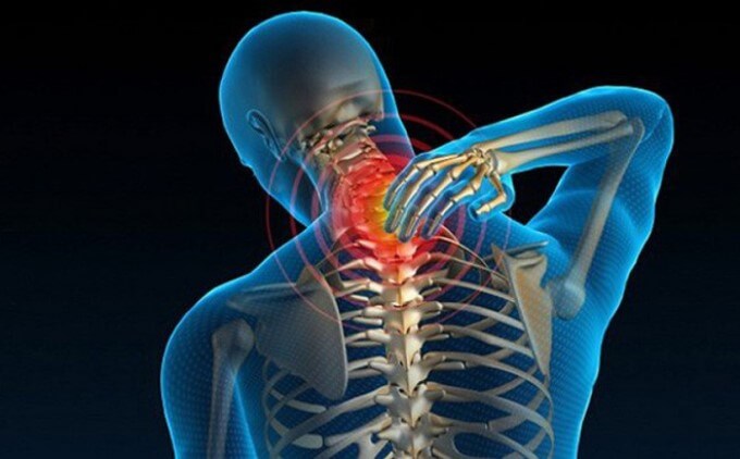 Thoát Vị Đĩa Đệm Cột Sống Cổ C5 C6 Là Phổ Biến Nhất