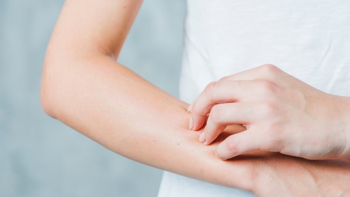 Hầu Hết Các Loại Viêm Mạch Máu Thường Là Bệnh Hiếm Gặp