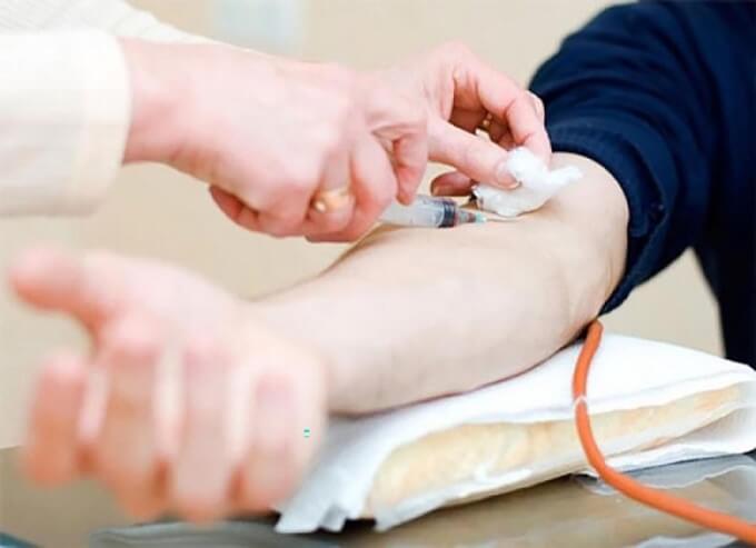 Điều Trị Viêm Mạch Máu Bao Gồm Ngăn Ngừa Tình Trạng Viêm Và Ngăn Ngừa Tái Phát