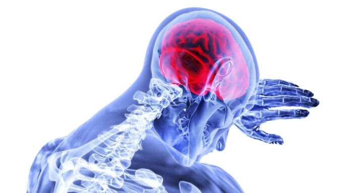 Viêm Màng Não Là Một Trong Những Biến Chứng Có Thể Gặp Khi Bị Viêm Tai Xương Chũm Mạn Tính