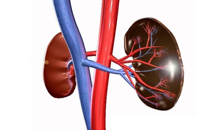 Người Mắc Bệnh Thận Mạn Có Nguy Cơ Bị Vôi Hoá Van Tim