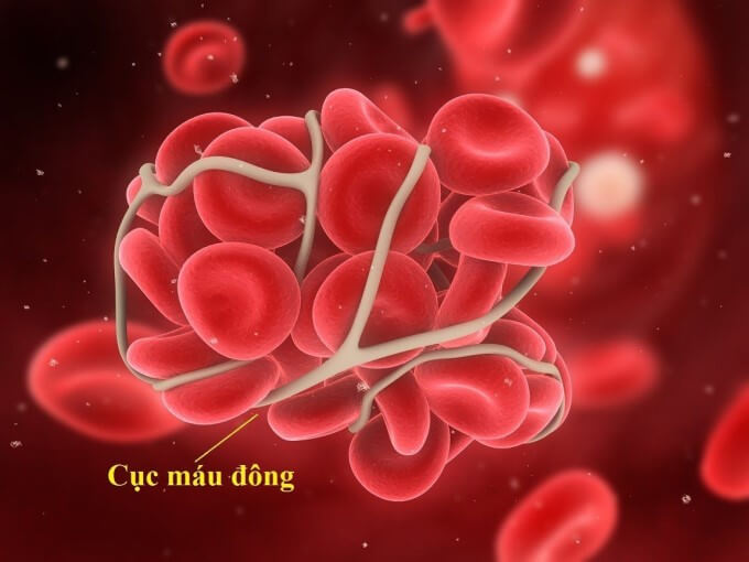 Sử Dụng Thuốc Chống Đông Máu