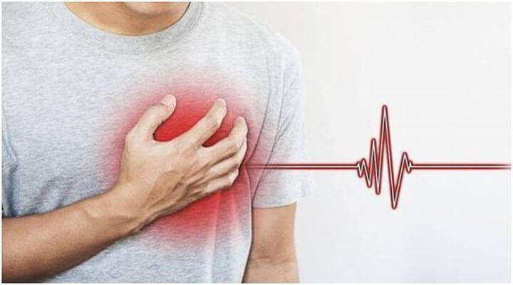 Nhồi máu cơ tim cấp – căn bệnh đáng sợ mà mọi người nên biết!