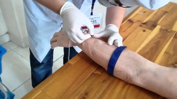 Truyền Tĩnh Mạch Để Ngăn Giảm Huyết Áp