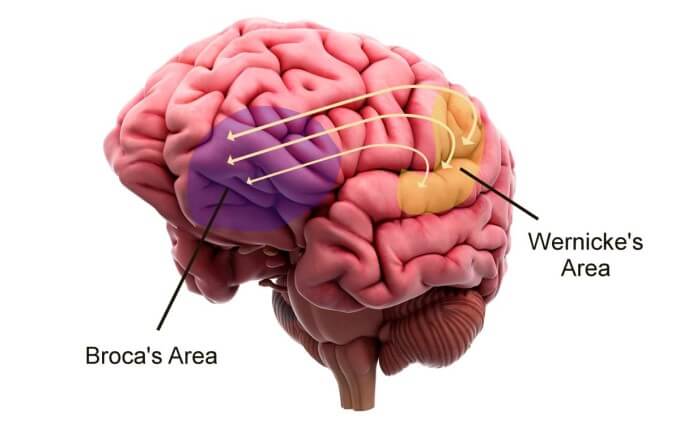 Tai biến mạch máu não được chia thành 2 thể lâm sàng