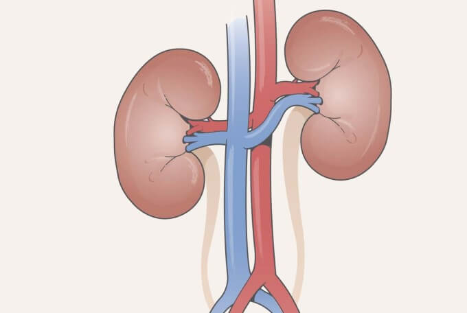 Tăng Huyết Áp Thứ Cấp Có Thể Làm Hẹp Mạch Máu Trong Thận