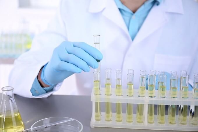 Xét Nghiệm Nước Tiểu, Phân Tích Nguyên Nhân Tăng Huyết Áp