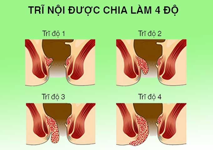 Tao-Bon-Gay-Benh-Tri-4