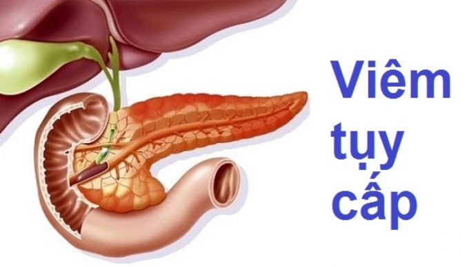 Viêm Tủy Cấp